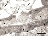 黄砂吸入後のマウスの肺胞壁傷害：電子顕微鏡写真
