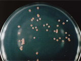 水道水から高頻度に分離される従属栄養細菌の一種、Methylobacterium 属菌の集落