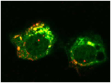 Self-antigen localization in Dendritic cell